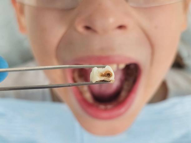 Best Emergency Orthodontic Repairs in Dekal, IL